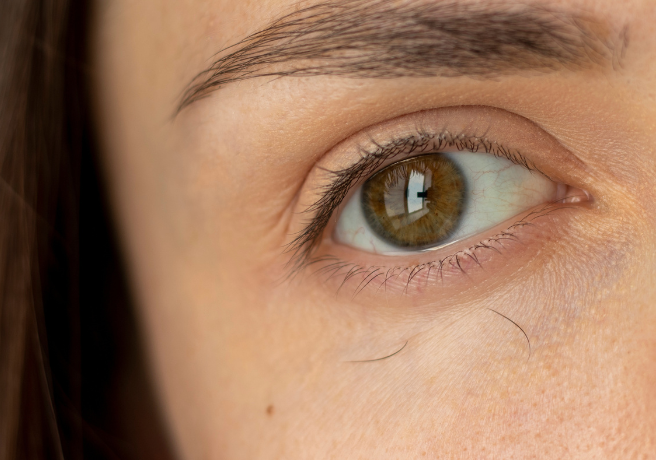 Tratamientos para las Cejas Caídas IML